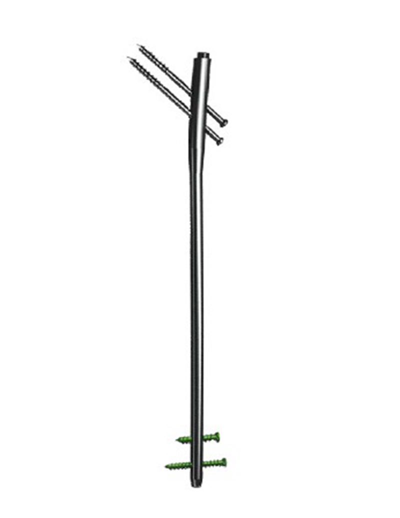 Femoral Reconstruction Nail