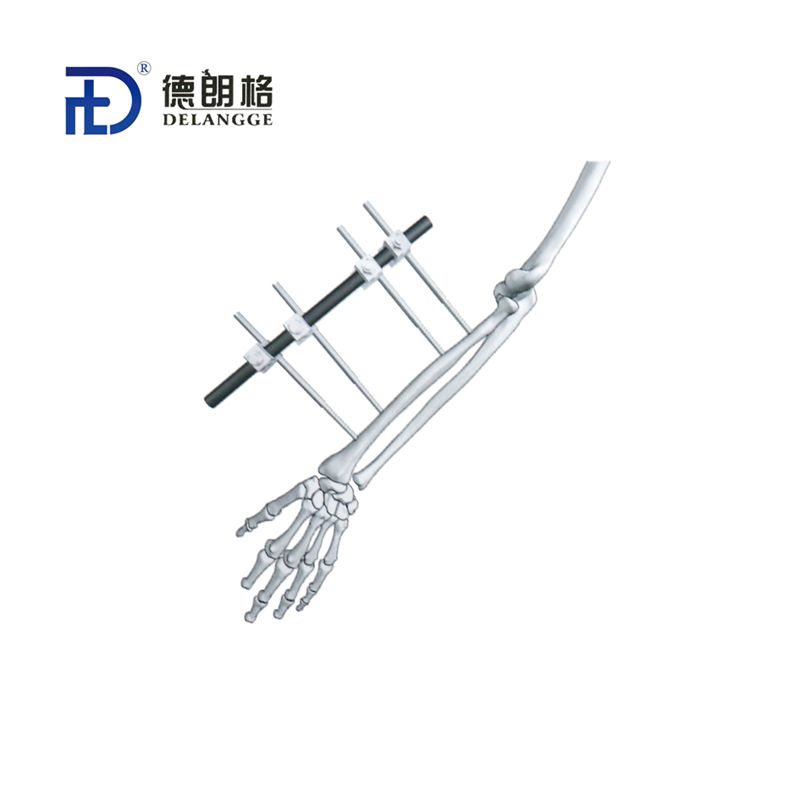 Radial Combined External Fixator