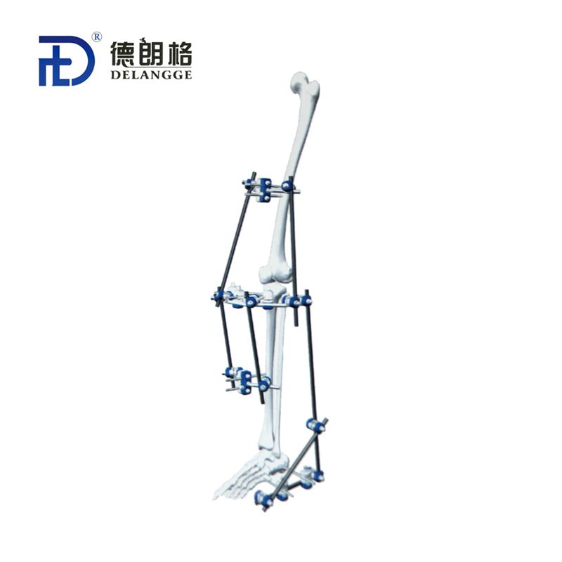 Hybrid Built Composite External Fixator