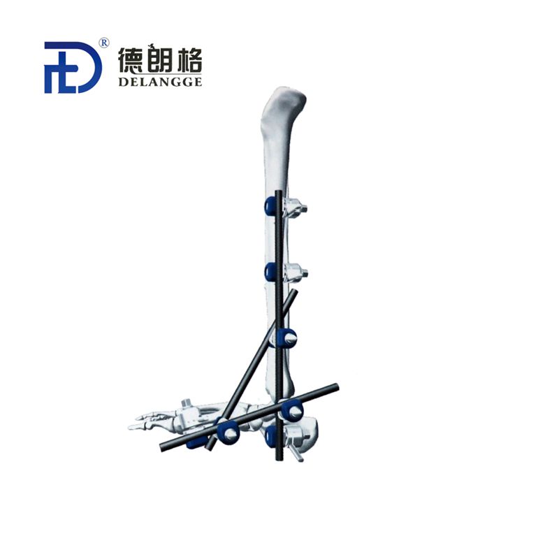 Ankle Frame Combined External Fixation