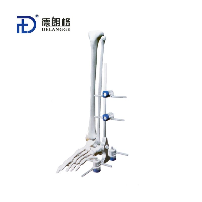 Ankle Combined External Fixator