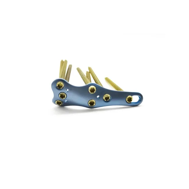 Forefoot/Midfoot Fusion Locking Plate